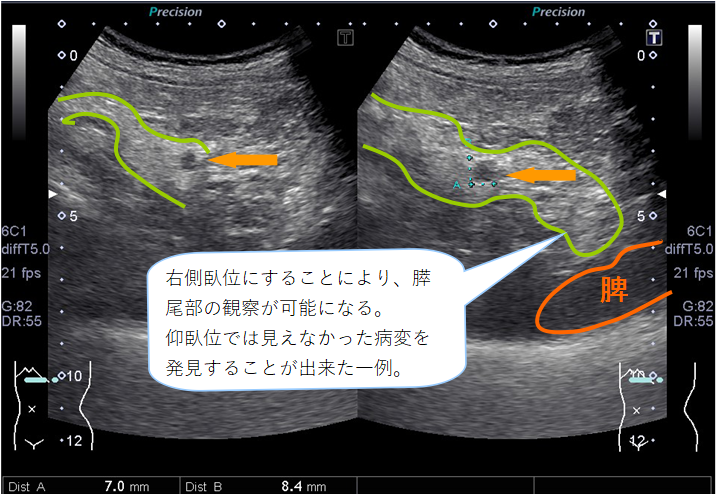 エコー検査について 巣鴨駅前胃腸内科クリニック