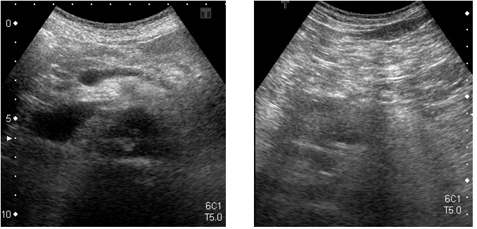 エコー検査について 巣鴨駅前胃腸内科クリニック