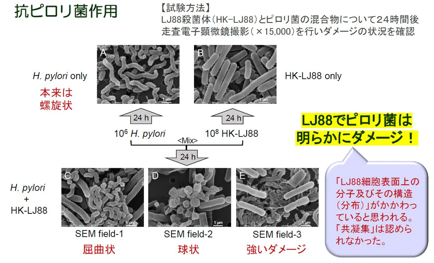 ピロリ菌除菌に2回失敗…それでも除菌できる？専門医が実例で解説｜巣鴨