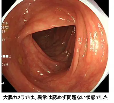 過敏性腸症候群（IBS）巣鴨駅前胃腸内科クリニック