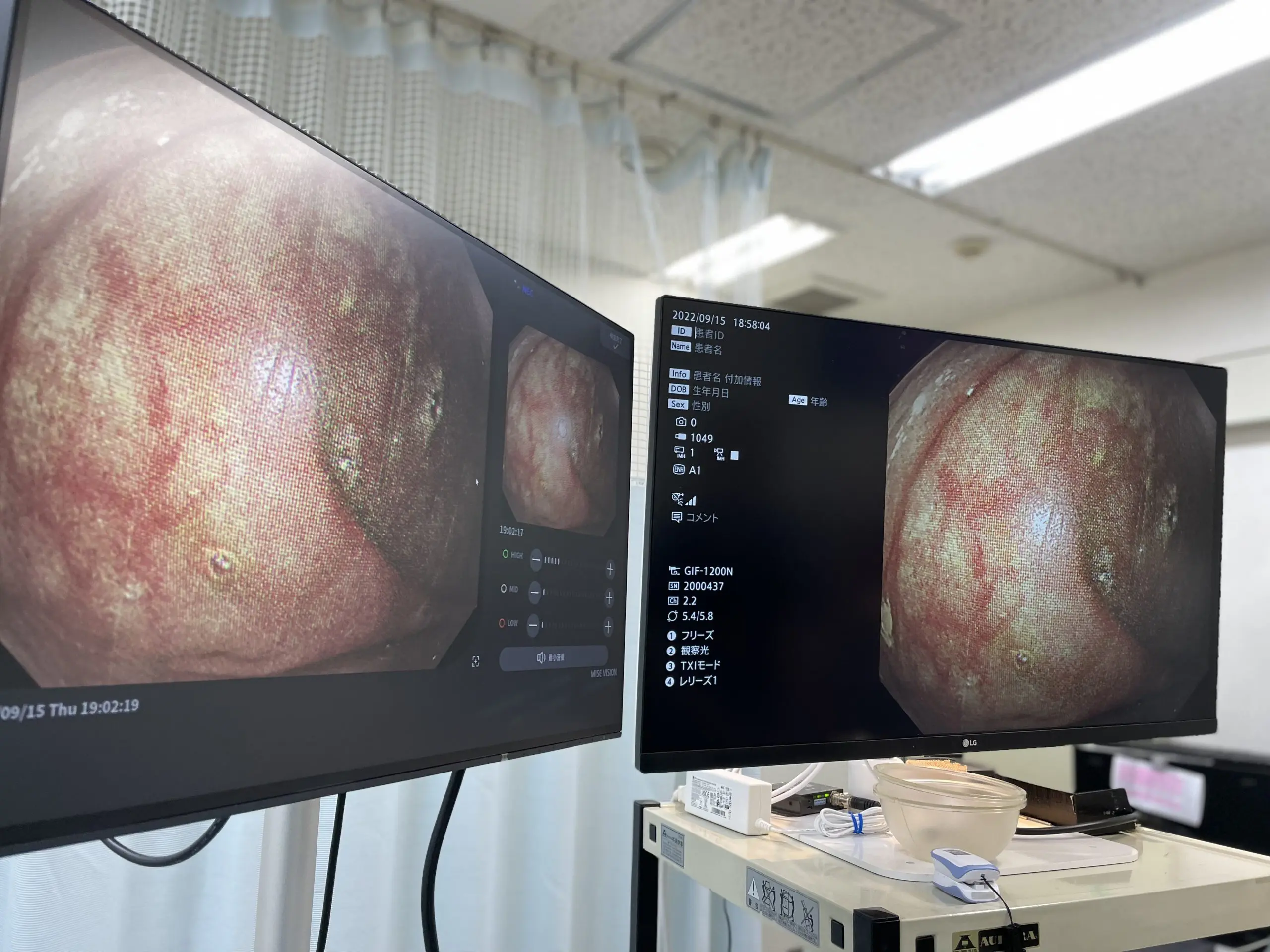 オリンパス製次世代内視鏡システムEVIS-X1を導入しました 巣鴨 オリンパス製次世代内視鏡システムEVIS-X1を導入しました 巣鴨