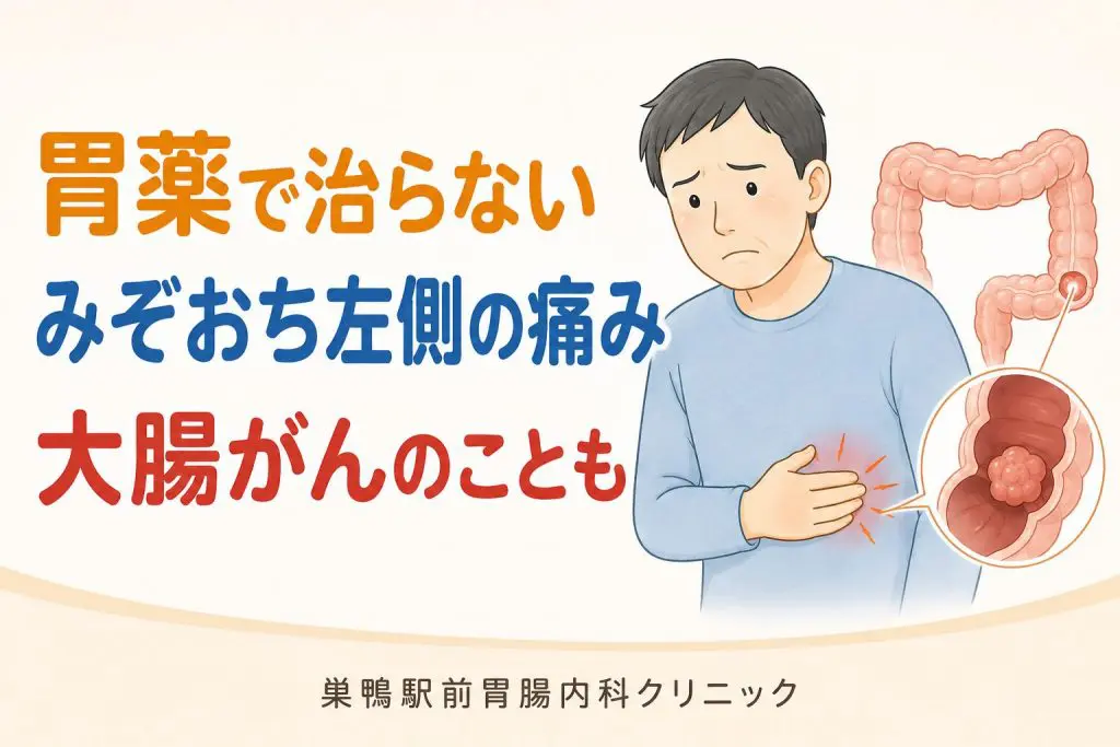 実際の治療例【みぞおちの左側の痛みで発見された大腸がん】胃や膵臓