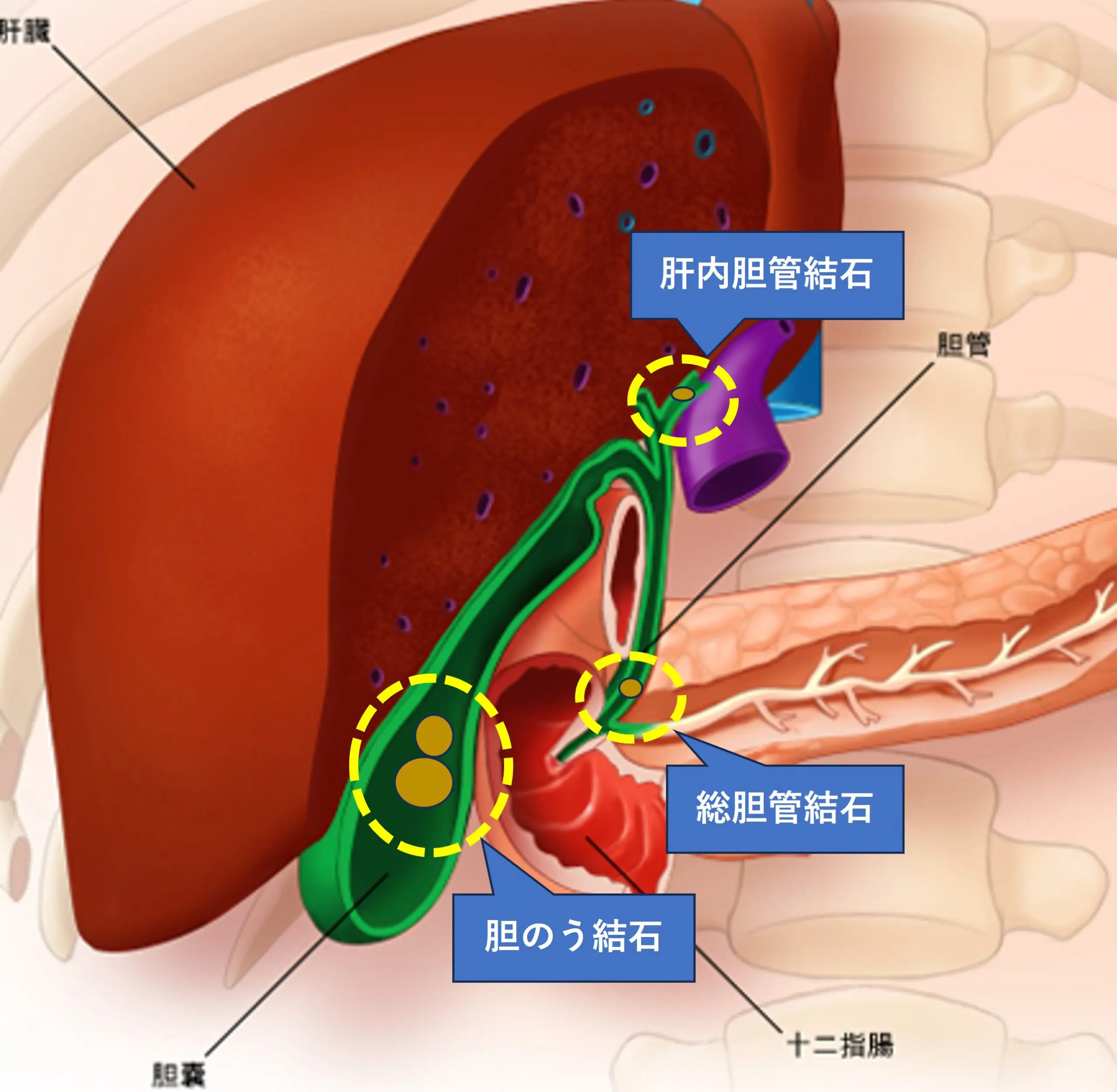 胆石の原因・検査・治療法｜巣鴨駅前胃腸内科クリニック
