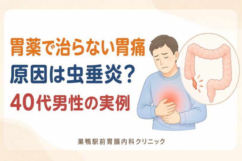 胃薬で良くならない“みぞおちの痛み”…実は急性虫垂炎だった｜初期症状