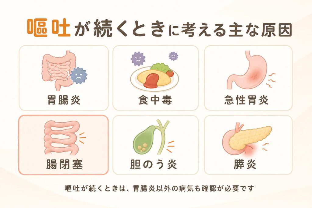 嘔吐が続く原因は腸閉塞？｜胃腸炎との違いと受診の目安を専門医の巣鴨駅前胃腸内科院長が実例で解説