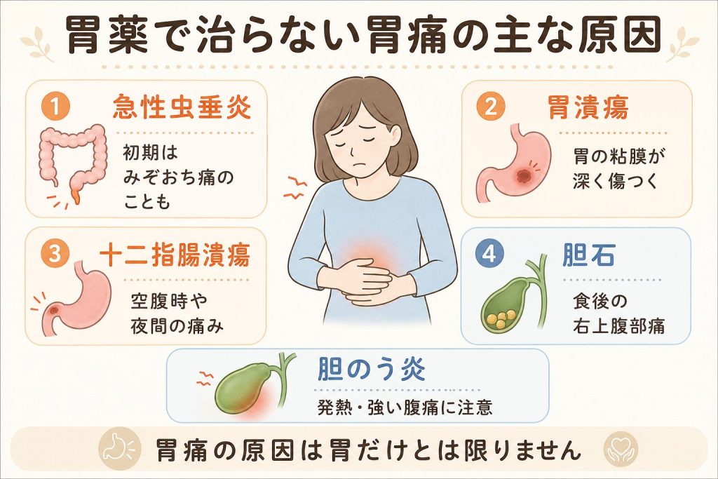 胃薬で良くならない“みぞおちの痛み”…実は急性虫垂炎だった｜初期症状