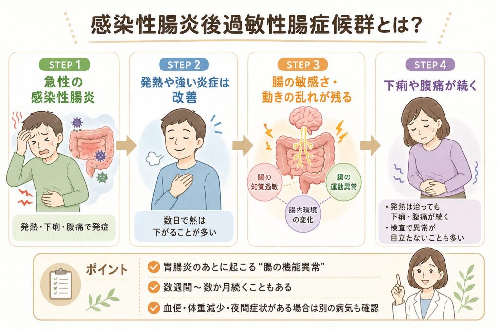 発熱は治ったのに下痢と腹痛が続く原因｜感染性腸炎後IBSの治療例