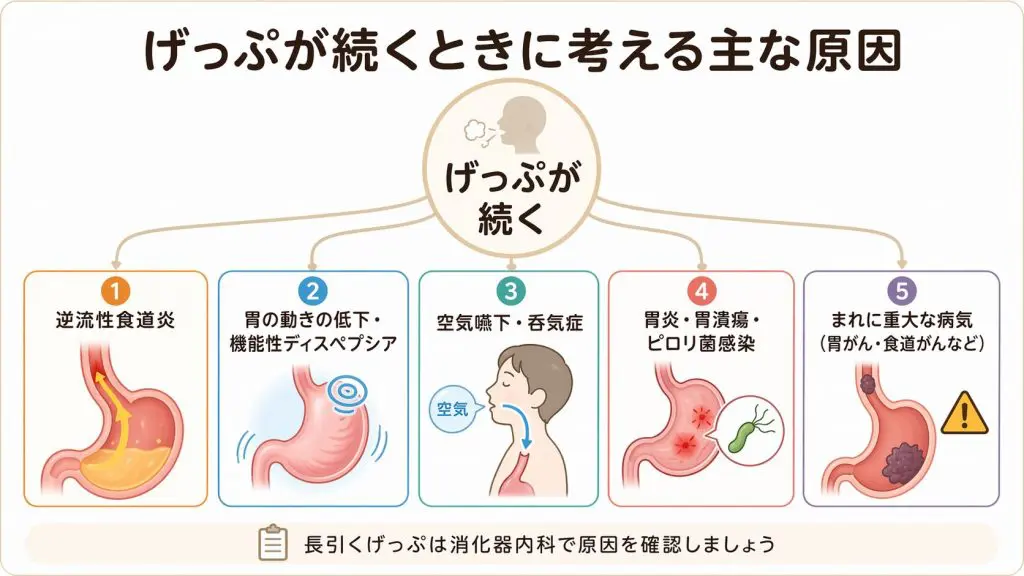 半年続くげっぷの原因は逆流性食道炎？PPIで改善しない50代女性の治療