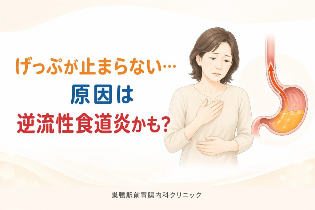 半年続くげっぷの原因は逆流性食道炎？PPIで改善しない50代女性の治療