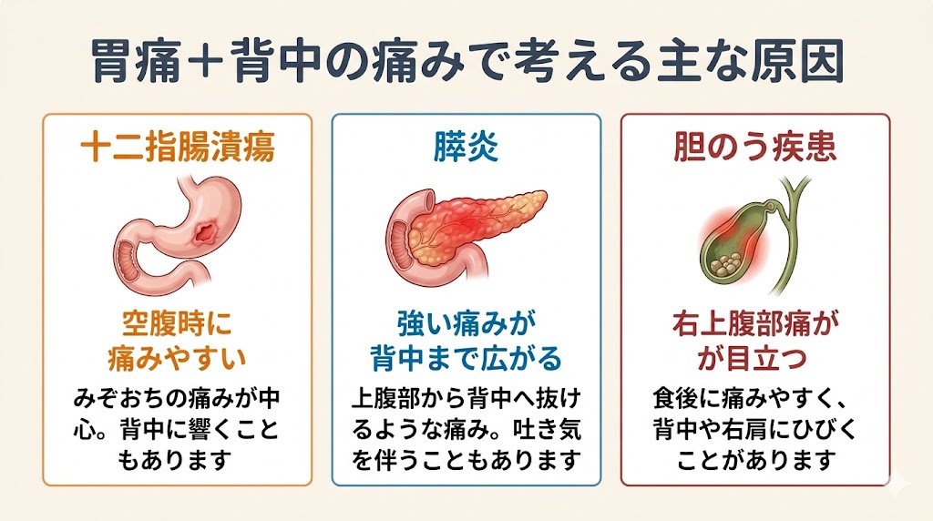 空腹時の胃痛と背中の痛みで考える十二指腸潰瘍・膵炎・胆のう疾患の違いを示した図