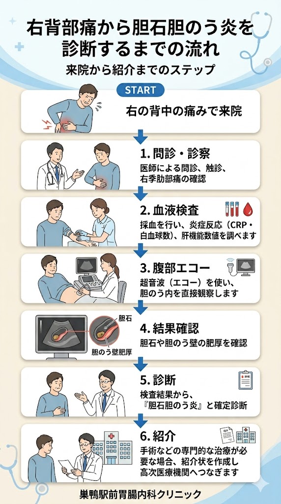 右の背中の痛みを繰り返す患者に対して、血液検査と腹部エコーで胆石胆のう炎を診断する流れを示した図