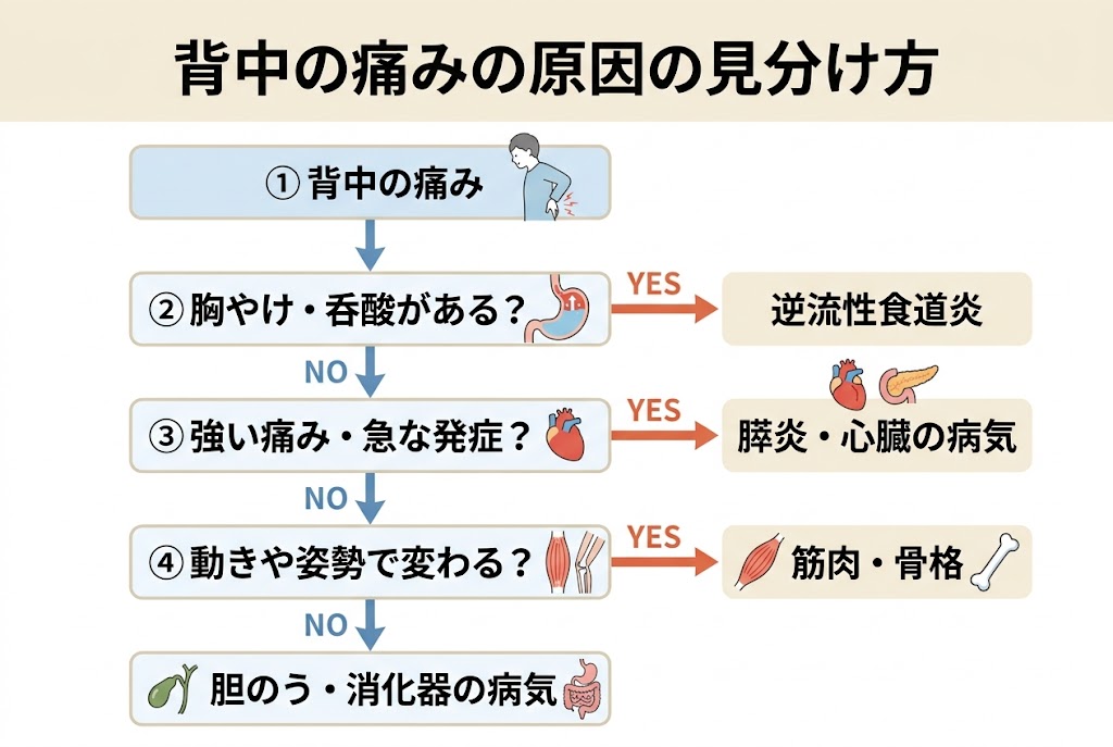 背中の痛みの原因をフローチャート形式で整理し、逆流性食道炎、心臓病、膵炎、胆のう疾患、筋肉痛などの見分け方を示した医療インフォグラフィック