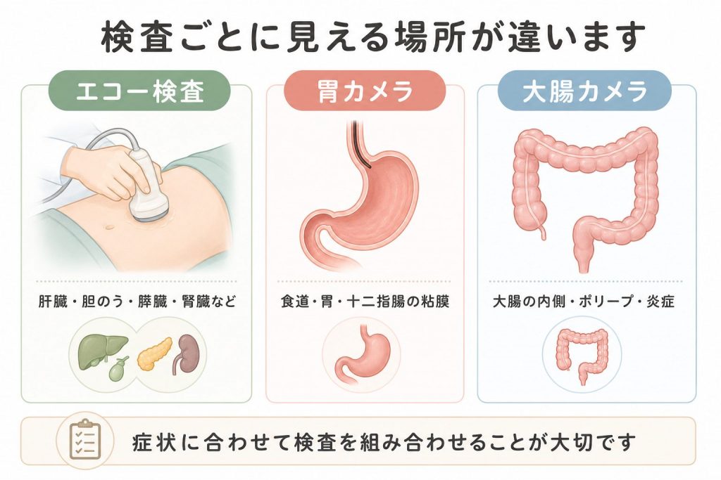 エコー検査（超音波検査）でみえるもの、みえないもの｜巣鴨駅前胃腸