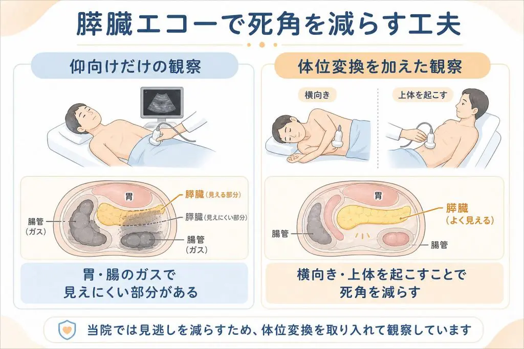 巣鴨のエコー検査｜腹部・甲状腺・頸動脈エコーの費用と流れ｜巣鴨駅前